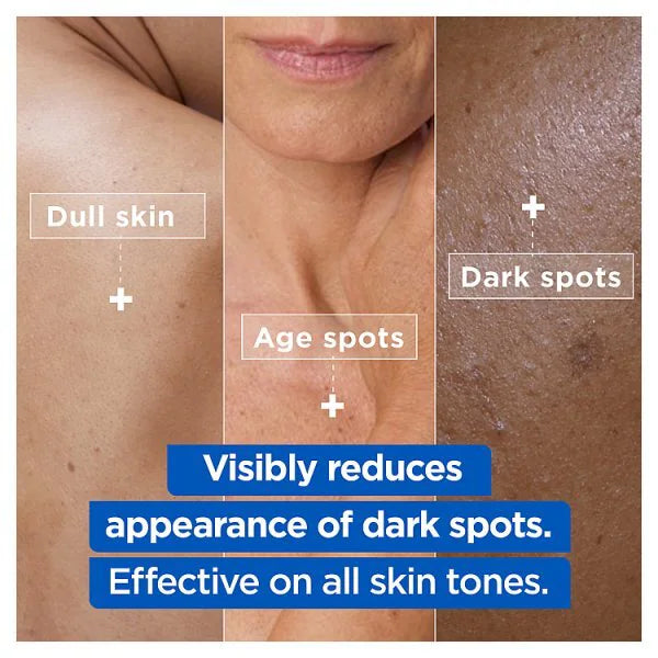 Mixa Niacinamide Bright Moisturising Anti-Dark Spot Cream