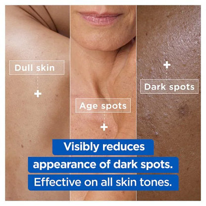 Mixa Niacinamide Bright Moisturising Anti-Dark Spot Cream